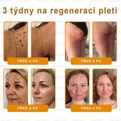 Lenaro® Krém s včelím jedem na obnovu pokožky 🏅 pomáhá při řešení kožních problémů, jako jsou: vrásky, jizvy, pigmentové skvrny, strie, akné, lupénka, ekzém, kožní léze, podráždění, záněty a další kožní potíže.