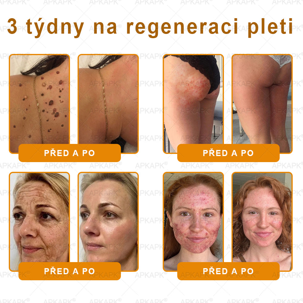 Lenaro® Krém s včelím jedem na obnovu pokožky 🍃 pomáhá při řešení kožních problémů, jako jsou: vrásky, jizvy, pigmentové skvrny, strie, akné, lupénka, ekzém, kožní léze, podráždění, záněty a další kožní potíže.