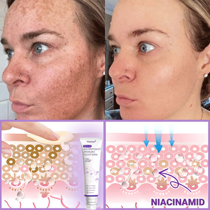 Vitalisys®☀️PDRN Multi-Peptide Masážní tělový krém s válečkem — proti stárnutí, hydratuje, zpevňuje a liftinguje pokožku, podporuje regeneraci, sjednocuje tón pleti a pečuje o nedokonalosti a tmavé skvrny.🍎