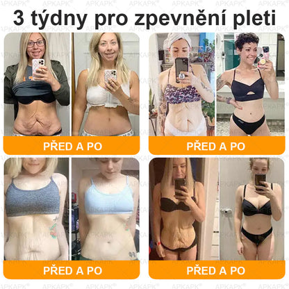 Lenaro® Krém s včelím jedem na obnovu pokožky 🐝 pomáhá při řešení kožních problémů, jako jsou: vrásky, jizvy, pigmentové skvrny, strie, akné, lupénka, ekzém, kožní léze, podráždění, záněty a další kožní potíže.