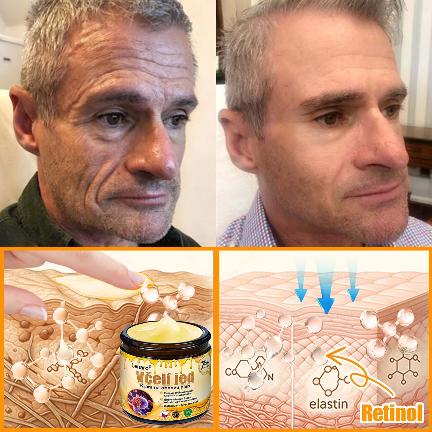 Lenaro® Krém s včelím jedem na obnovu pokožky 🐝 pomáhá při řešení kožních problémů, jako jsou: vrásky, jizvy, pigmentové skvrny, strie, akné, lupénka, ekzém, kožní léze, podráždění, záněty a další kožní potíže.