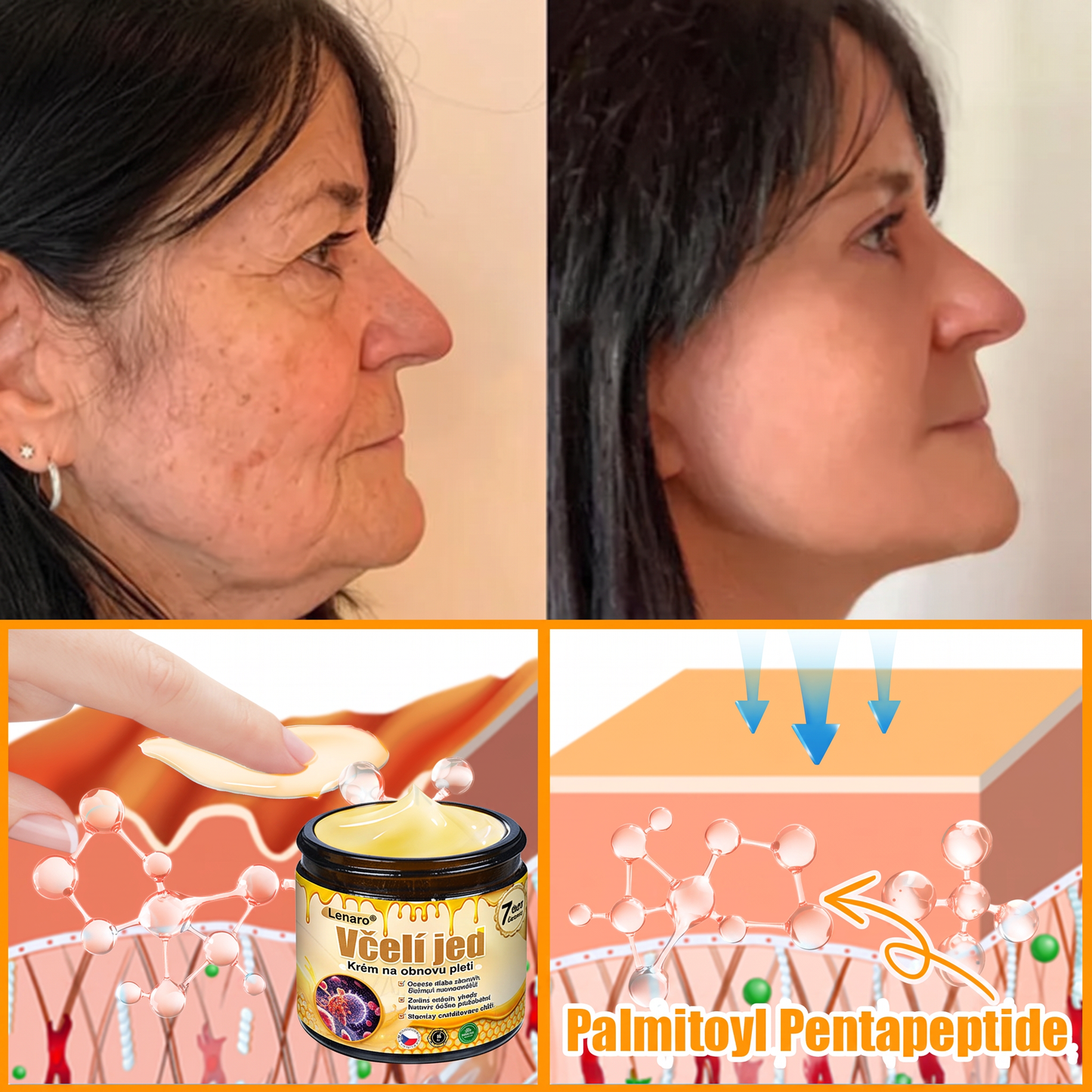Lenaro® Krém s včelím jedem na obnovu pokožky 🌟 pomáhá při řešení kožních problémů, jako jsou: vrásky, jizvy, pigmentové skvrny, strie, akné, lupénka, ekzém, kožní léze, podráždění, záněty a další kožní potíže.