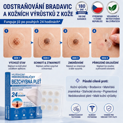 👩‍⚕️🎉 Oficiální obchod | MURWON® 👑 Mikrojehličkové náplasti pro dokonalou pleť a odstranění kožních nedokonalostí (Pro kožní výrůstky, malé kožní útvary, bradavice, mateřská znaménka, stařecké skvrny a pigmentové nepravidelnosti.)