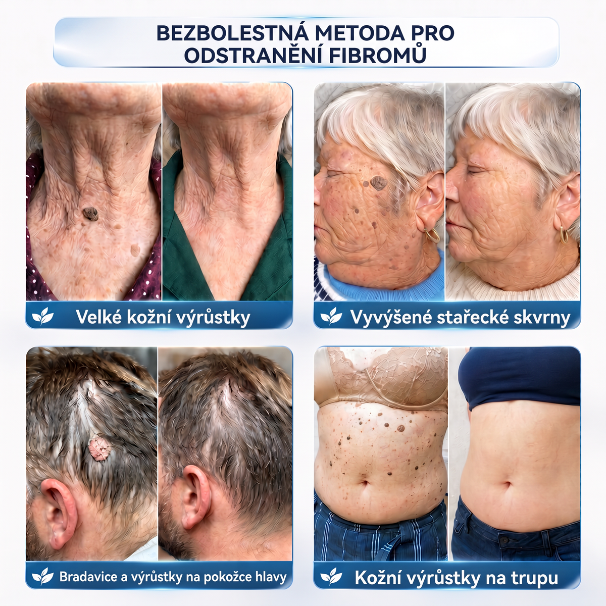 👩‍⚕️🎁Vitalisys® 𝟕𝐝𝐞𝐧𝐧í 𝐤𝐫é𝐦 𝐧𝐚 𝐨𝐝𝐬𝐭𝐫𝐚𝐧ě𝐧í 𝐤𝐨ž𝐧í𝐜𝐡 𝐯ý𝐫ů𝐬𝐭𝐤ů 𝐚 𝐬𝐤𝐯𝐫𝐧 (𝐁𝐞𝐳𝐛𝐨𝐥𝐞𝐬𝐭𝐧á 𝐟𝐨𝐫𝐦𝐮𝐥𝐚 – 𝐁𝐞𝐳 𝐣𝐢𝐳𝐞𝐯)🍈