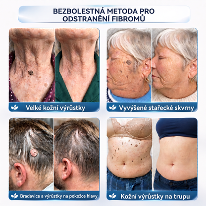👩‍⚕️🎁Vitalisys® 𝟕𝐝𝐞𝐧𝐧í 𝐤𝐫é𝐦 𝐧𝐚 𝐨𝐝𝐬𝐭𝐫𝐚𝐧ě𝐧í 𝐤𝐨ž𝐧í𝐜𝐡 𝐯ý𝐫ů𝐬𝐭𝐤ů 𝐚 𝐬𝐤𝐯𝐫𝐧 (𝐁𝐞𝐳𝐛𝐨𝐥𝐞𝐬𝐭𝐧á 𝐟𝐨𝐫𝐦𝐮𝐥𝐚 – 𝐁𝐞𝐳 𝐣𝐢𝐳𝐞𝐯)🍈