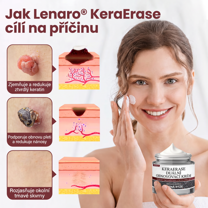 Lenaro® KeraErase Dvouúčinkový obnovující krém