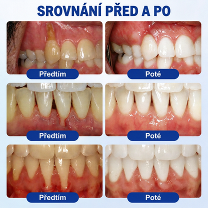 🇨🇿 🎁VITALISYS®🦷 𝑮𝒖𝒎𝑹𝒆𝒗𝒊𝒗𝒆 Parodontální regenerační gel🍊