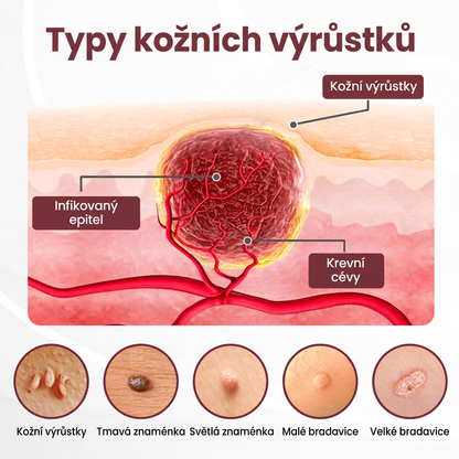 Lenaro® KeraErase Dvouúčinkový obnovující krém