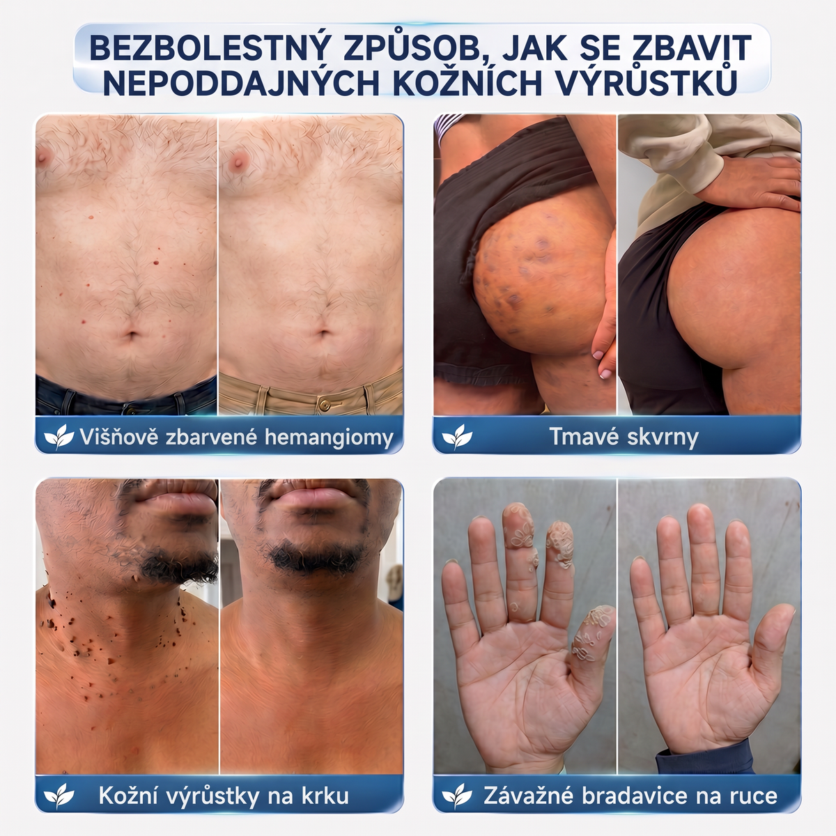 👩‍⚕️🎁Vitalisys® 𝟕𝐝𝐞𝐧𝐧í 𝐤𝐫é𝐦 𝐧𝐚 𝐨𝐝𝐬𝐭𝐫𝐚𝐧ě𝐧í 𝐤𝐨ž𝐧í𝐜𝐡 𝐯ý𝐫ů𝐬𝐭𝐤ů 𝐚 𝐬𝐤𝐯𝐫𝐧 (𝐁𝐞𝐳𝐛𝐨𝐥𝐞𝐬𝐭𝐧á 𝐟𝐨𝐫𝐦𝐮𝐥𝐚 – 𝐁𝐞𝐳 𝐣𝐢𝐳𝐞𝐯)🍈