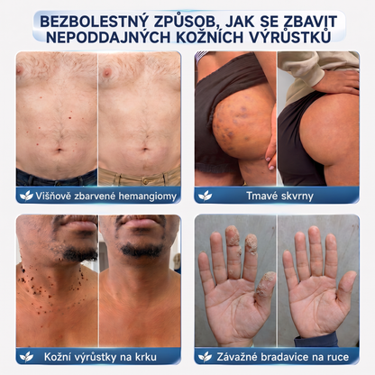 👩‍⚕️🎁Vitalisys® 𝟕𝐝𝐞𝐧𝐧í 𝐤𝐫é𝐦 𝐧𝐚 𝐨𝐝𝐬𝐭𝐫𝐚𝐧ě𝐧í 𝐤𝐨ž𝐧í𝐜𝐡 𝐯ý𝐫ů𝐬𝐭𝐤ů 𝐚 𝐬𝐤𝐯𝐫𝐧 (𝐁𝐞𝐳𝐛𝐨𝐥𝐞𝐬𝐭𝐧á 𝐟𝐨𝐫𝐦𝐮𝐥𝐚 – 𝐁𝐞𝐳 𝐣𝐢𝐳𝐞𝐯)🍈