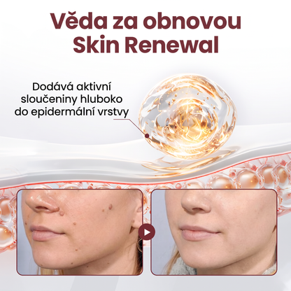 Lenaro® KeraErase Dvouúčinkový obnovující krém