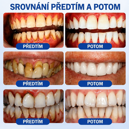 🇨🇿 🎁VITALISYS®🦷 𝑮𝒖𝒎𝑹𝒆𝒗𝒊𝒗𝒆 Parodontální regenerační gel🍊