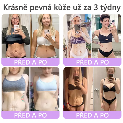 Vitalisys®⭐️PDRN Multi-Peptide Masážní tělový krém s válečkem — proti stárnutí, hydratuje, zpevňuje a liftinguje pokožku, podporuje regeneraci, sjednocuje tón pleti a pečuje o nedokonalosti a tmavé skvrny.