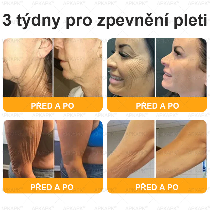 Lenaro® Krém s včelím jedem na obnovu pokožky 🏆 pomáhá při řešení kožních problémů, jako jsou: vrásky, jizvy, pigmentové skvrny, strie, akné, lupénka, ekzém, kožní léze, podráždění, záněty a další kožní potíže.