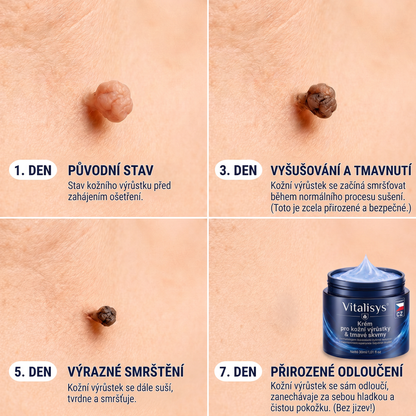 👩‍⚕️🎁Vitalisys® 𝟕𝐝𝐞𝐧𝐧í 𝐤𝐫é𝐦 𝐧𝐚 𝐨𝐝𝐬𝐭𝐫𝐚𝐧ě𝐧í 𝐤𝐨ž𝐧í𝐜𝐡 𝐯ý𝐫ů𝐬𝐭𝐤ů 𝐚 𝐬𝐤𝐯𝐫𝐧 (𝐁𝐞𝐳𝐛𝐨𝐥𝐞𝐬𝐭𝐧á 𝐟𝐨𝐫𝐦𝐮𝐥𝐚 – 𝐁𝐞𝐳 𝐣𝐢𝐳𝐞𝐯)🍈