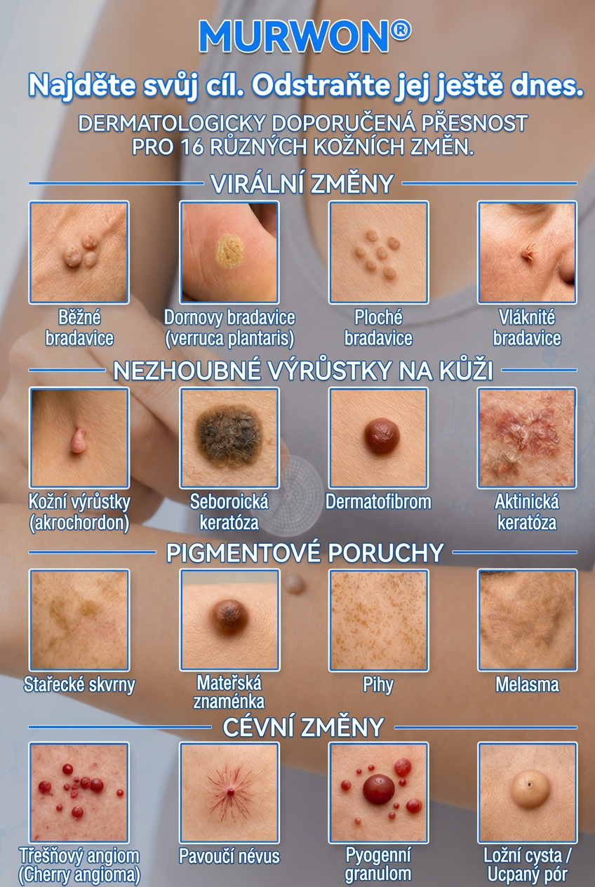 👩‍⚕️🎉 Oficiální obchod | MURWON® 👑 Mikrojehličkové náplasti pro dokonalou pleť a odstranění kožních nedokonalostí (Pro kožní výrůstky, malé kožní útvary, bradavice, mateřská znaménka, stařecké skvrny a pigmentové nepravidelnosti.)