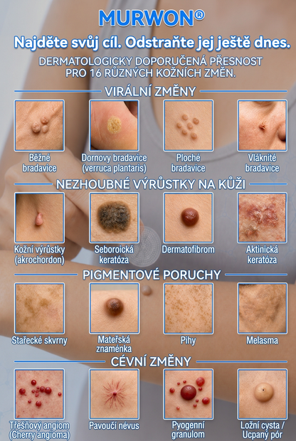 👩‍⚕️🎉 Oficiální obchod | MURWON® 👑 Mikrojehličkové náplasti pro dokonalou pleť a odstranění kožních nedokonalostí (Pro kožní výrůstky, malé kožní útvary, bradavice, mateřská znaménka, stařecké skvrny a pigmentové nepravidelnosti.)