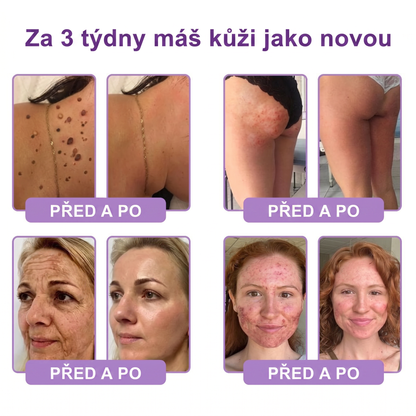 Vitalisys®☀️PDRN Multi-Peptide Masážní tělový krém s válečkem — proti stárnutí, hydratuje, zpevňuje a liftinguje pokožku, podporuje regeneraci, sjednocuje tón pleti a pečuje o nedokonalosti a tmavé skvrny.🍎