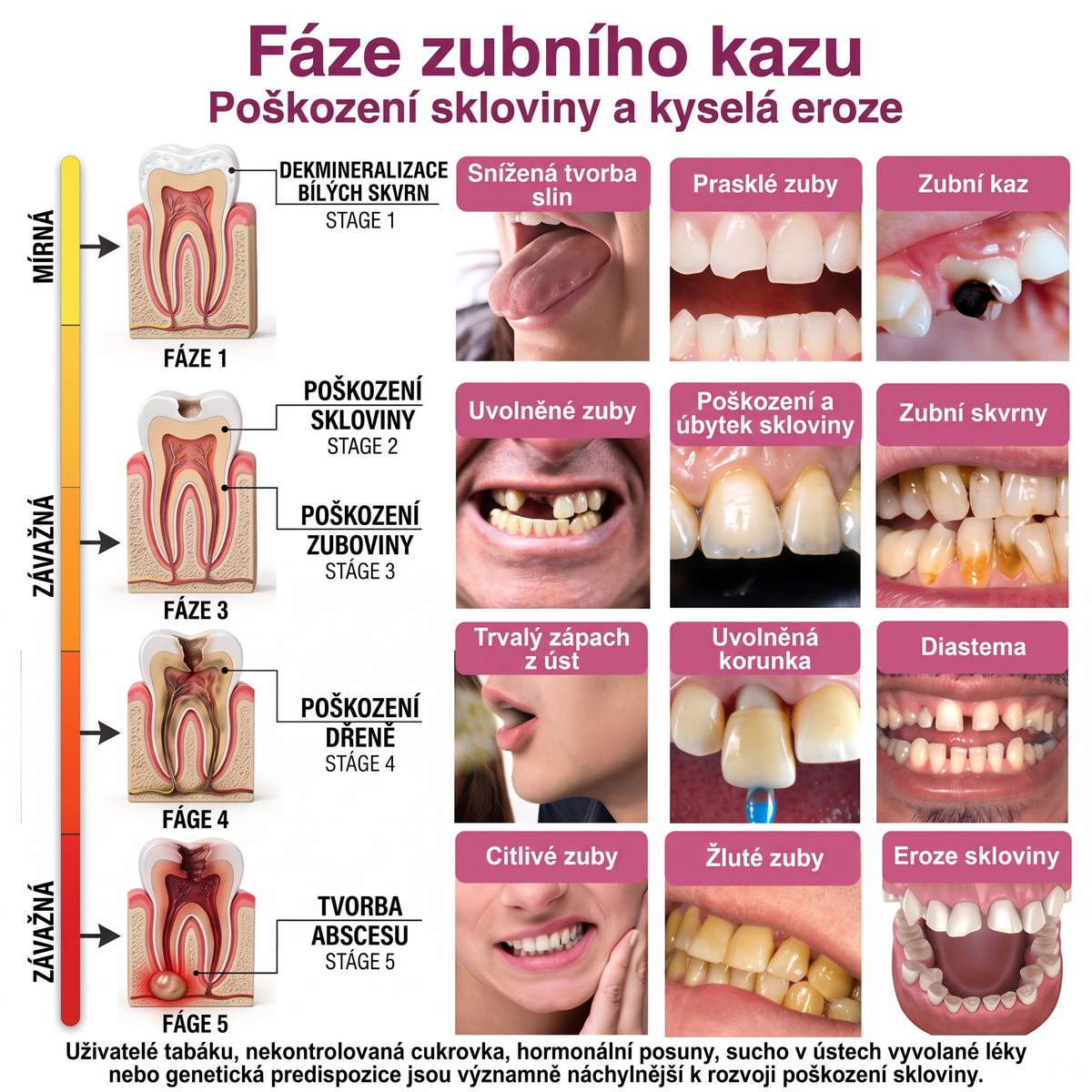 🦷VIGORIE®🦷 DenPerm – Natürliches Zahnschmelz-Füllgel zur Kariessanierung🎉