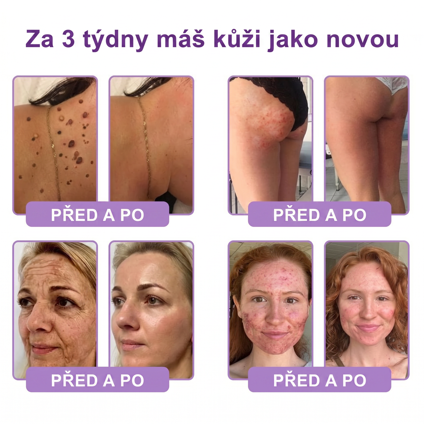 Vitalisys®⭐️PDRN Multi-Peptide Masážní tělový krém s válečkem — proti stárnutí, hydratuje, zpevňuje a liftinguje pokožku, podporuje regeneraci, sjednocuje tón pleti a pečuje o nedokonalosti a tmavé skvrny.