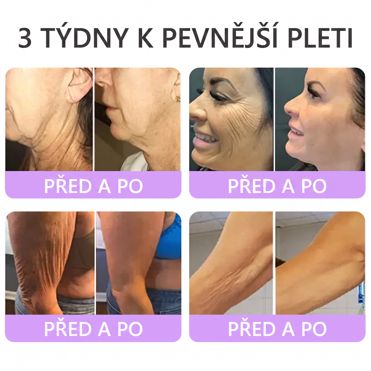 Vitalisys®⭐️PDRN Multi-Peptide Masážní tělový krém s válečkem — proti stárnutí, hydratuje, zpevňuje a liftinguje pokožku, podporuje regeneraci, sjednocuje tón pleti a pečuje o nedokonalosti a tmavé skvrny.