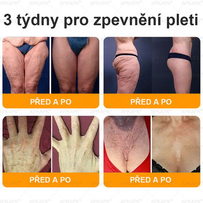 Lenaro® Krém s včelím jedem na obnovu pokožky 🏆 pomáhá při řešení kožních problémů, jako jsou: vrásky, jizvy, pigmentové skvrny, strie, akné, lupénka, ekzém, kožní léze, podráždění, záněty a další kožní potíže.