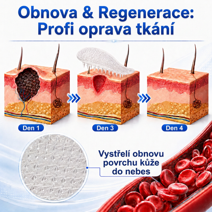 👩‍⚕️🎉 Oficiální obchod | MURWON® 👑 Mikrojehličkové náplasti pro dokonalou pleť a odstranění kožních nedokonalostí (Pro kožní výrůstky, malé kožní útvary, bradavice, mateřská znaménka, stařecké skvrny a pigmentové nepravidelnosti.)