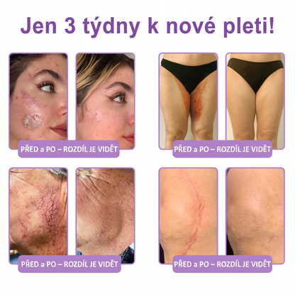 Vitalisys®⭐️PDRN Multi-Peptide Masážní tělový krém s válečkem — proti stárnutí, hydratuje, zpevňuje a liftinguje pokožku, podporuje regeneraci, sjednocuje tón pleti a pečuje o nedokonalosti a tmavé skvrny.