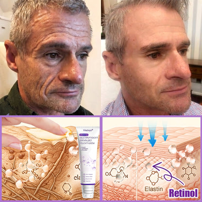 Vitalisys®⭐️PDRN Multi-Peptide Masážní tělový krém s válečkem — proti stárnutí, hydratuje, zpevňuje a liftinguje pokožku, podporuje regeneraci, sjednocuje tón pleti a pečuje o nedokonalosti a tmavé skvrny.