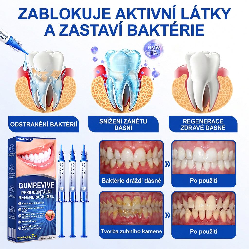 🇨🇿 🎁VITALISYS®🦷 𝑮𝒖𝒎𝑹𝒆𝒗𝒊𝒗𝒆 Parodontální regenerační gel🍊