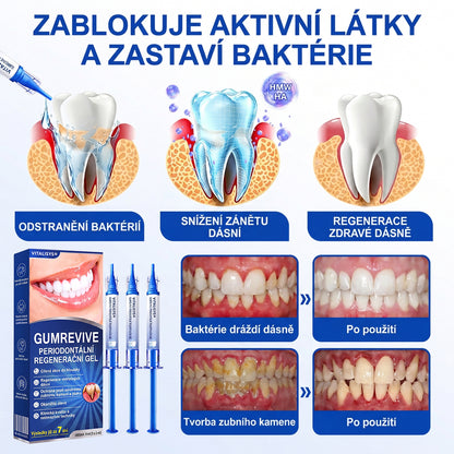 🇨🇿 🎁VITALISYS®🦷 𝑮𝒖𝒎𝑹𝒆𝒗𝒊𝒗𝒆 Parodontální regenerační gel🍊